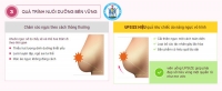 Viên uống hỗ trợ giúp nở ngực Upsize Breast Pills New