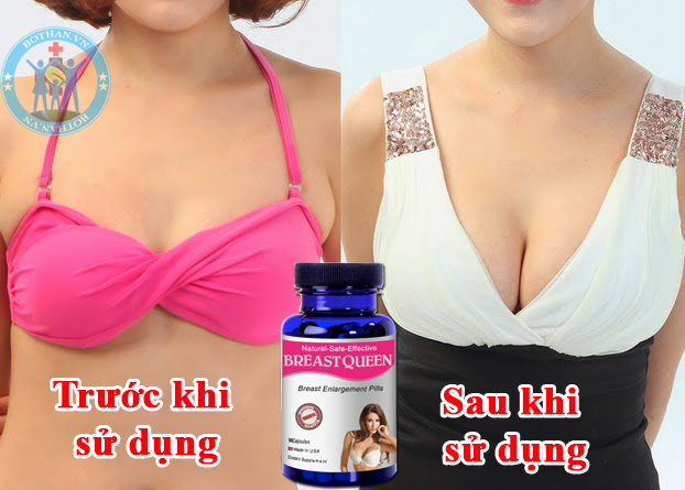 Breast Queen tăng kích thước vòng 1 Breast Queen tăng kích thước vòng 1