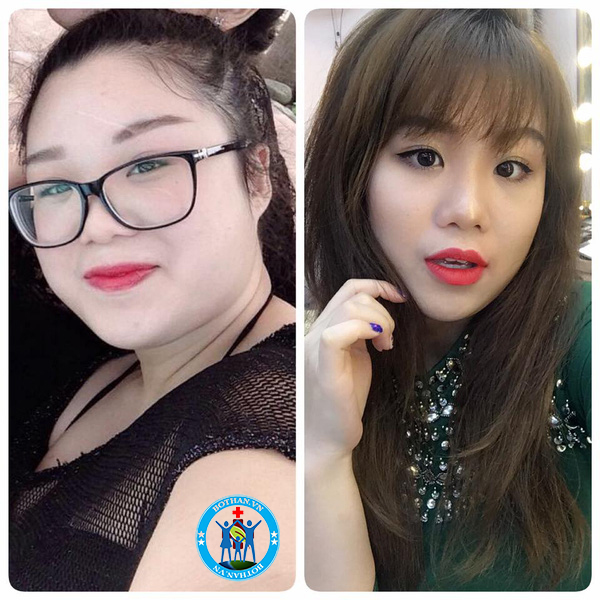 Đánh giá của khách hàng về viên uống giảm cân AB