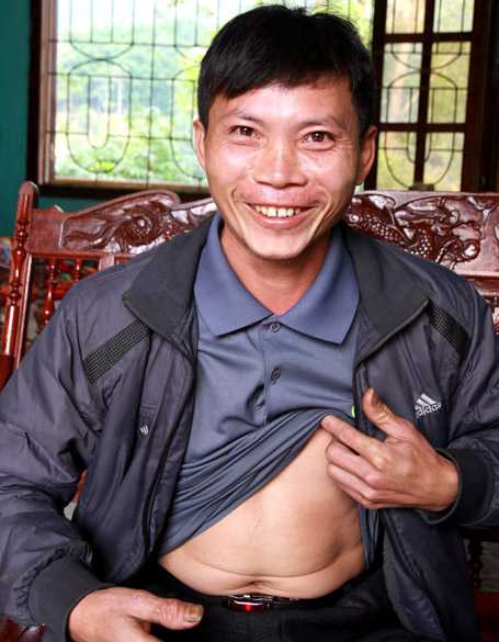 khách hàng Liver Detox