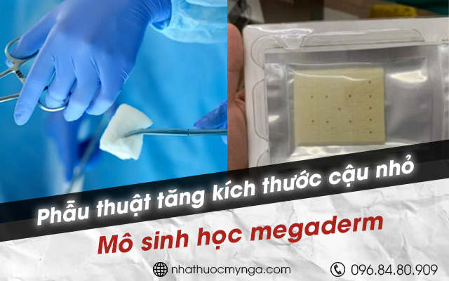 Tăng kích thước dương vât phẫu thuật bằng mảnh mô sinh học
