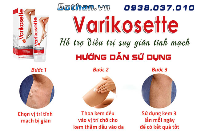 hướng dẫn sử dụng varisokette